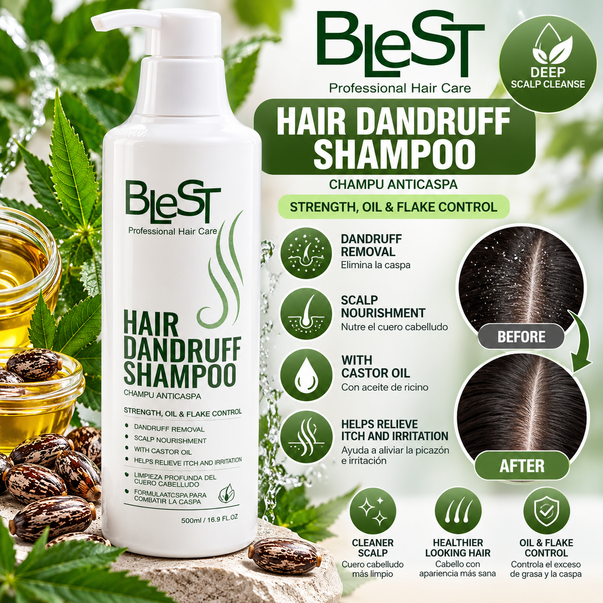 BleST Professional Hair Dandruff Shampoo with Castor Oil – 500ml | Scalp Care &amp; Flake Control